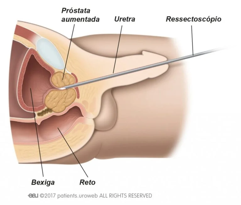 BPE_05_PT_figure-1-1024x870-768x653